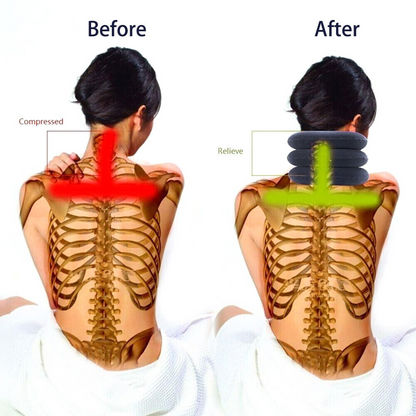 Cervical Neck Traction Device