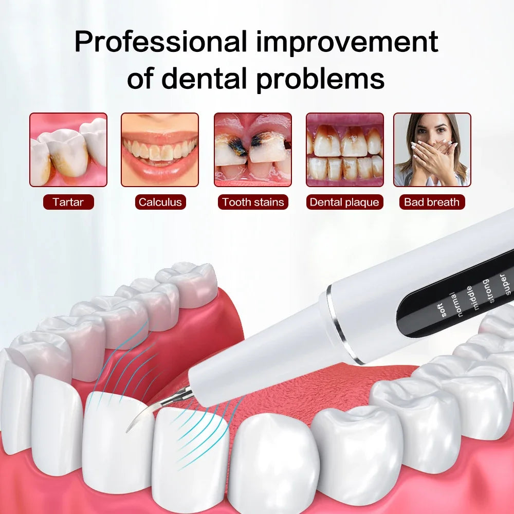 Ultrasonic Electric Dental Cleaner