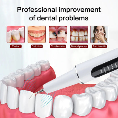Ultrasonic Electric Dental Cleaner