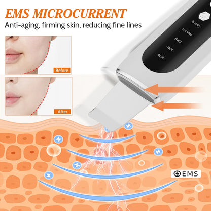 Ultrasonic Scrubber EMS Microcurrent Face Lifting