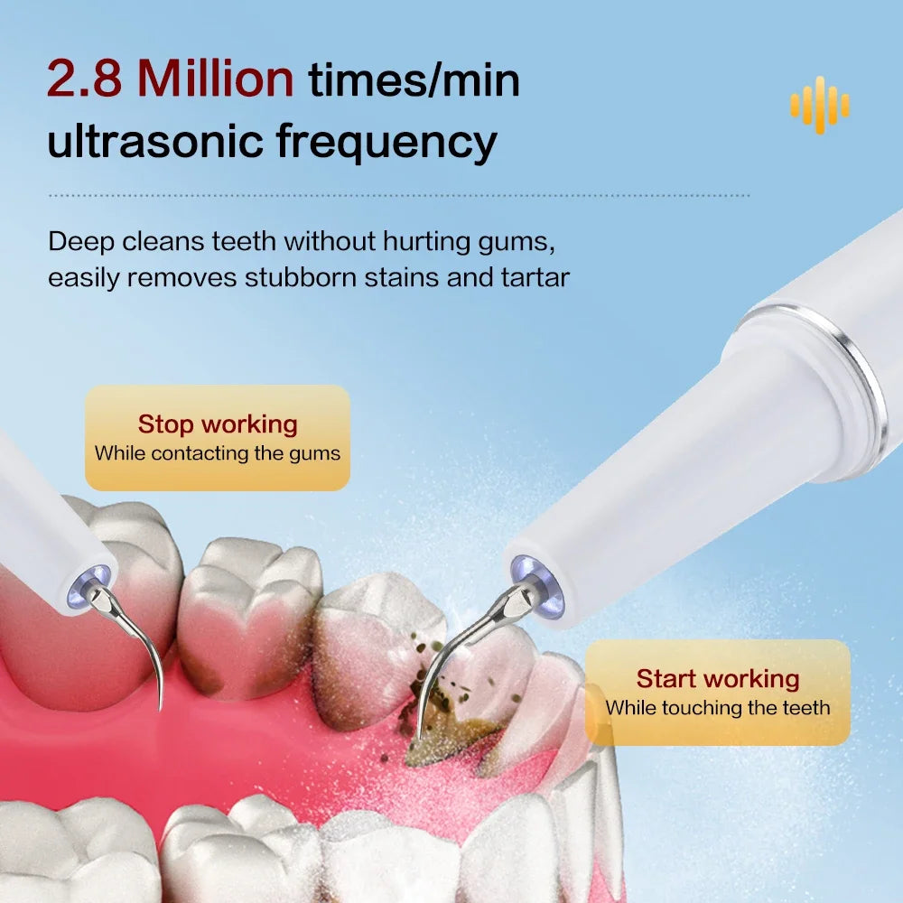 Ultrasonic Electric Dental Cleaner